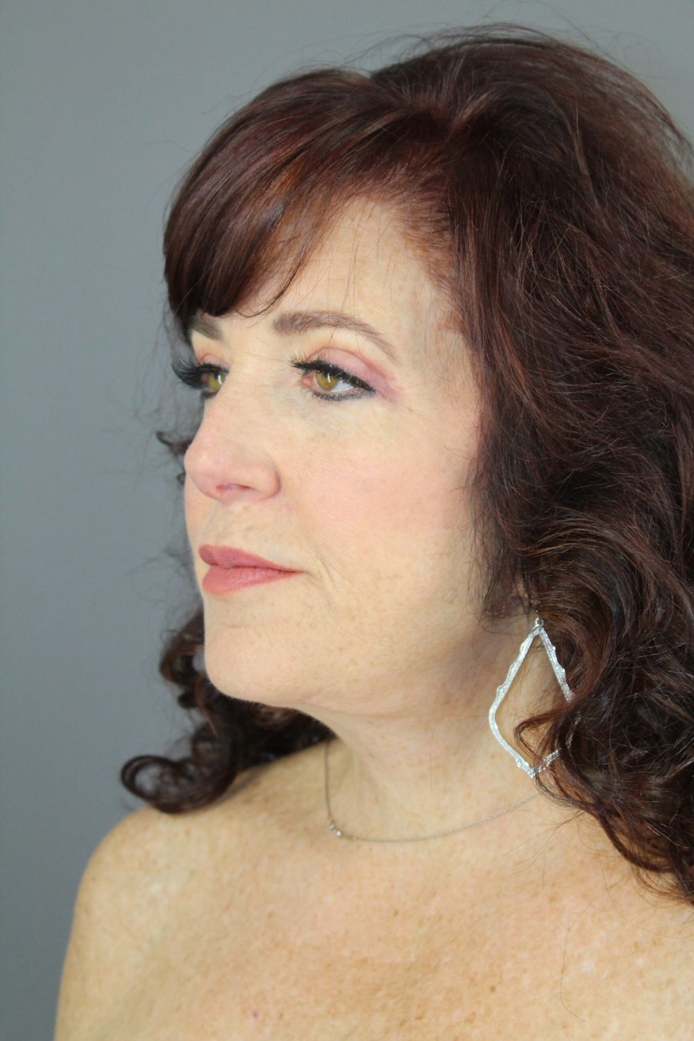 Face Lift Before & After