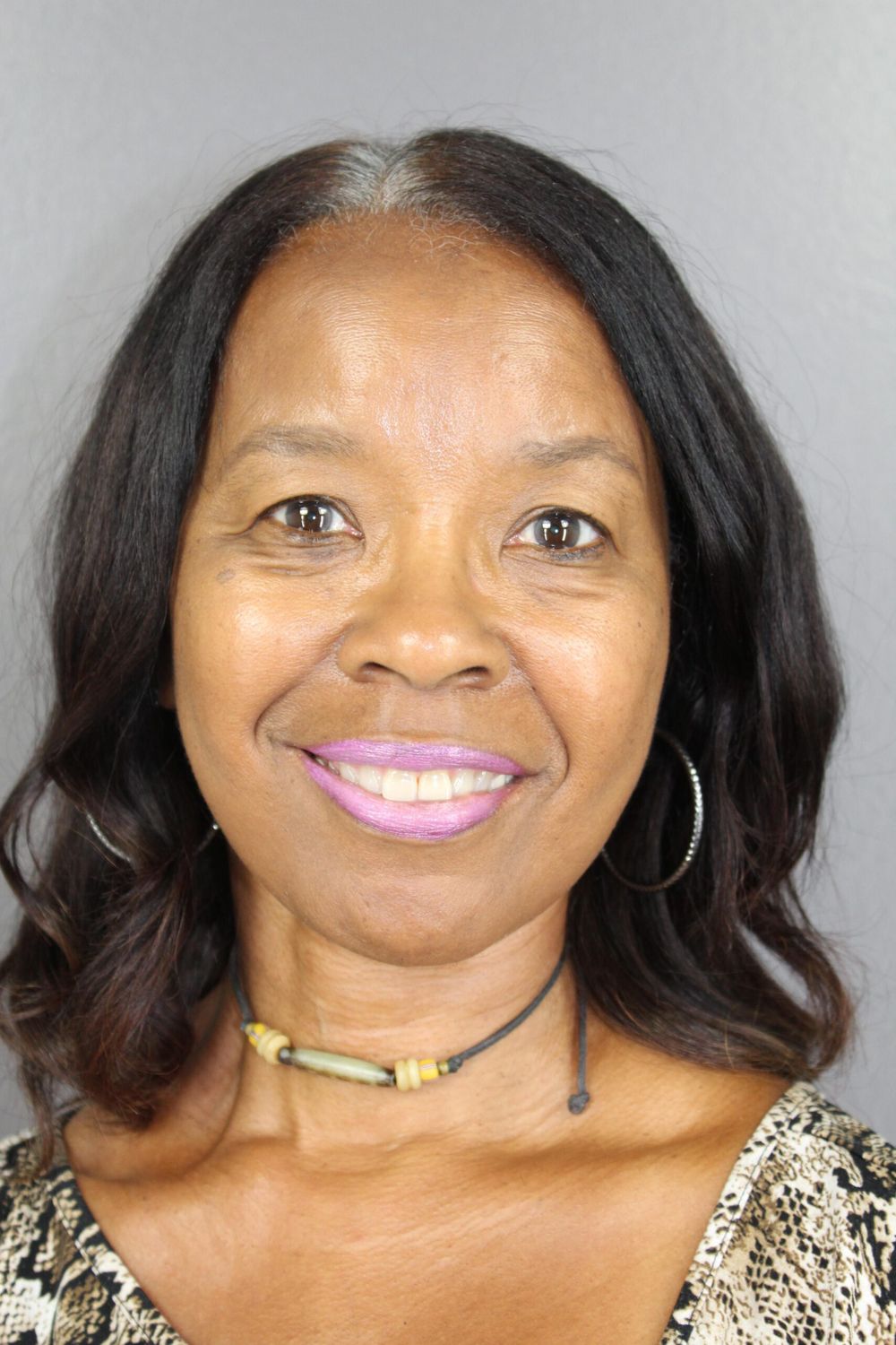 Face Lift Before & After