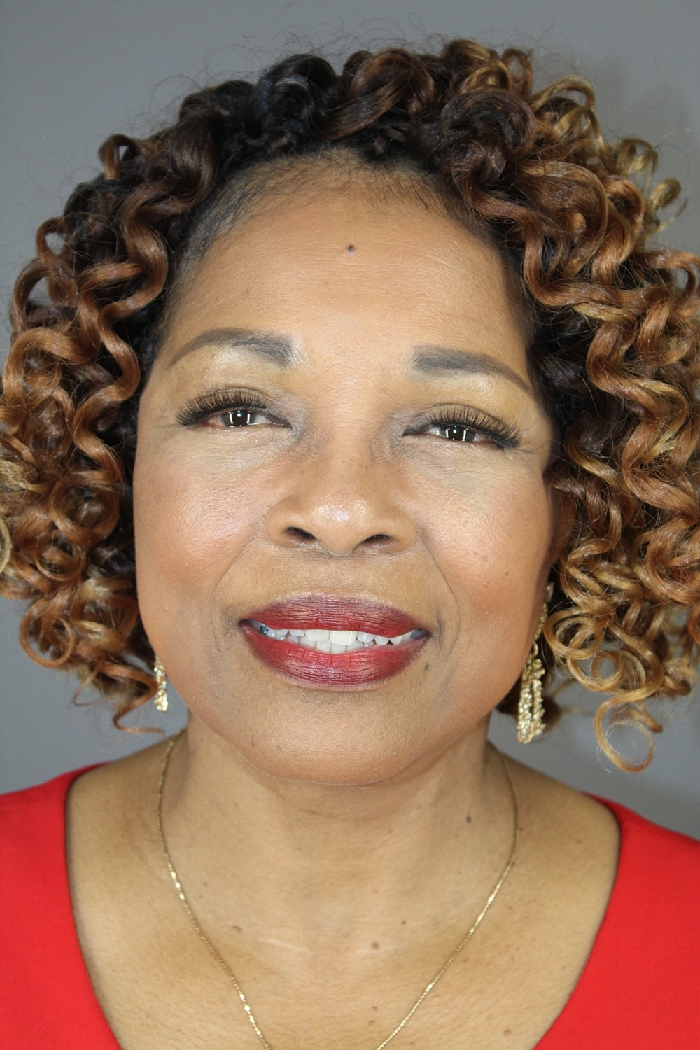 Face Lift Before & After