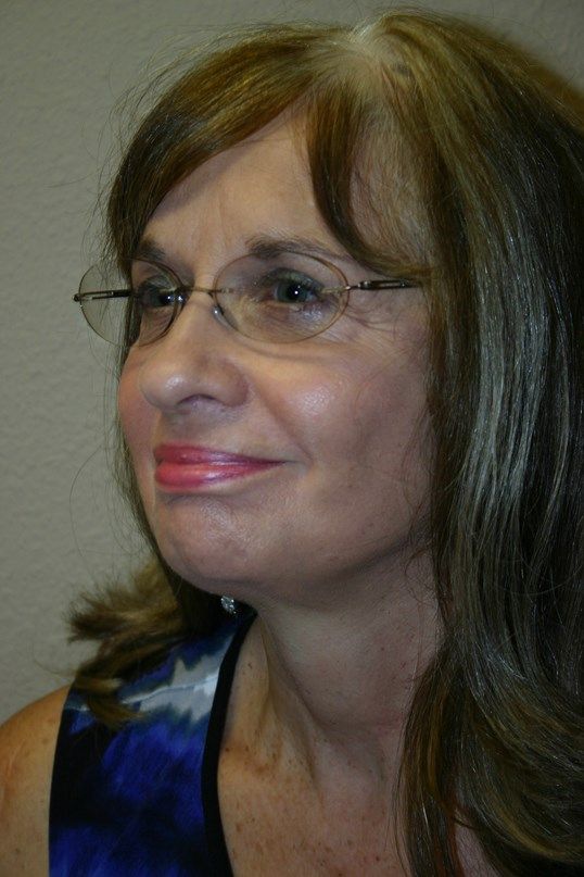 Face Lift Before & After