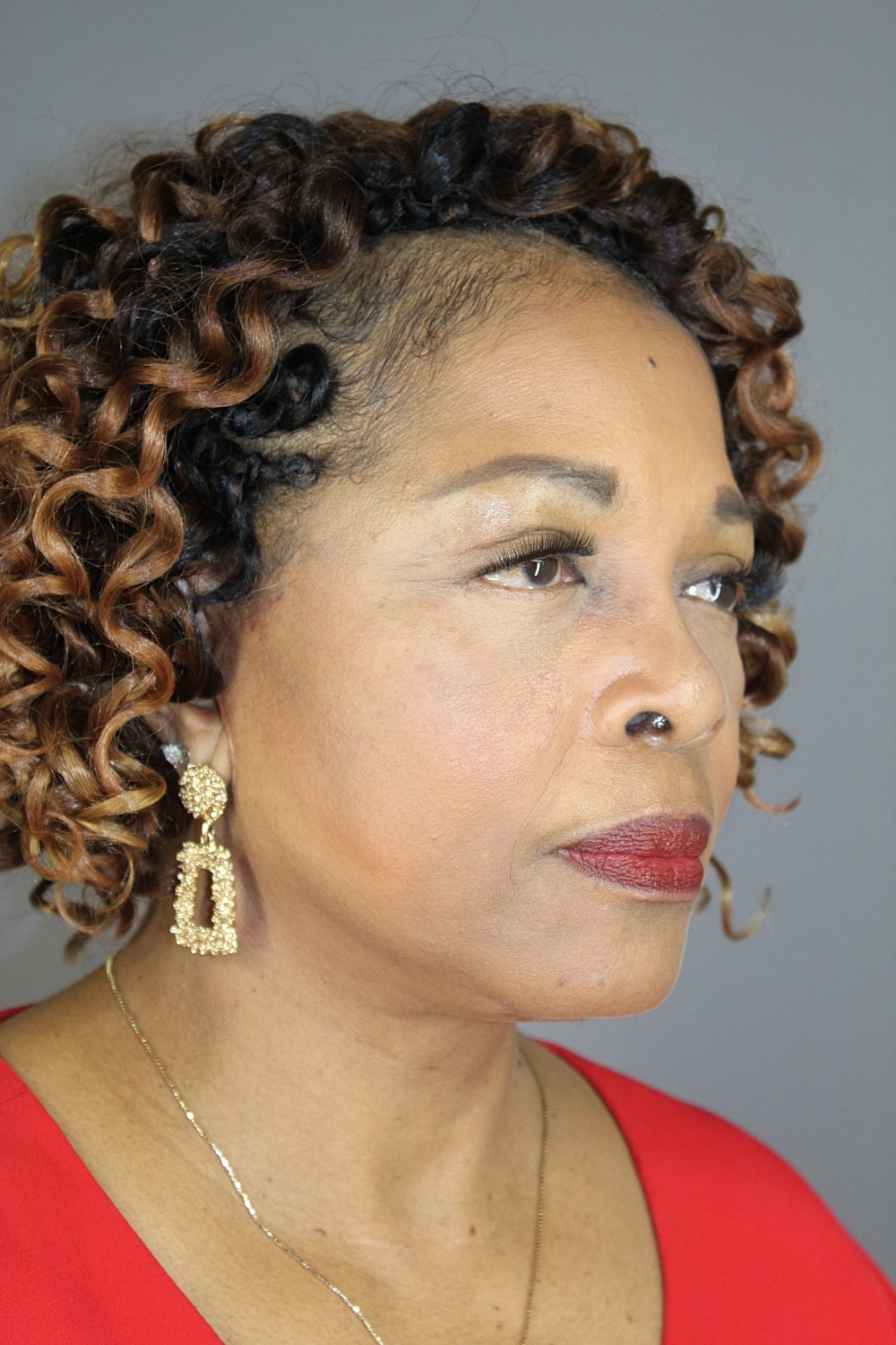 Face Lift Before & After