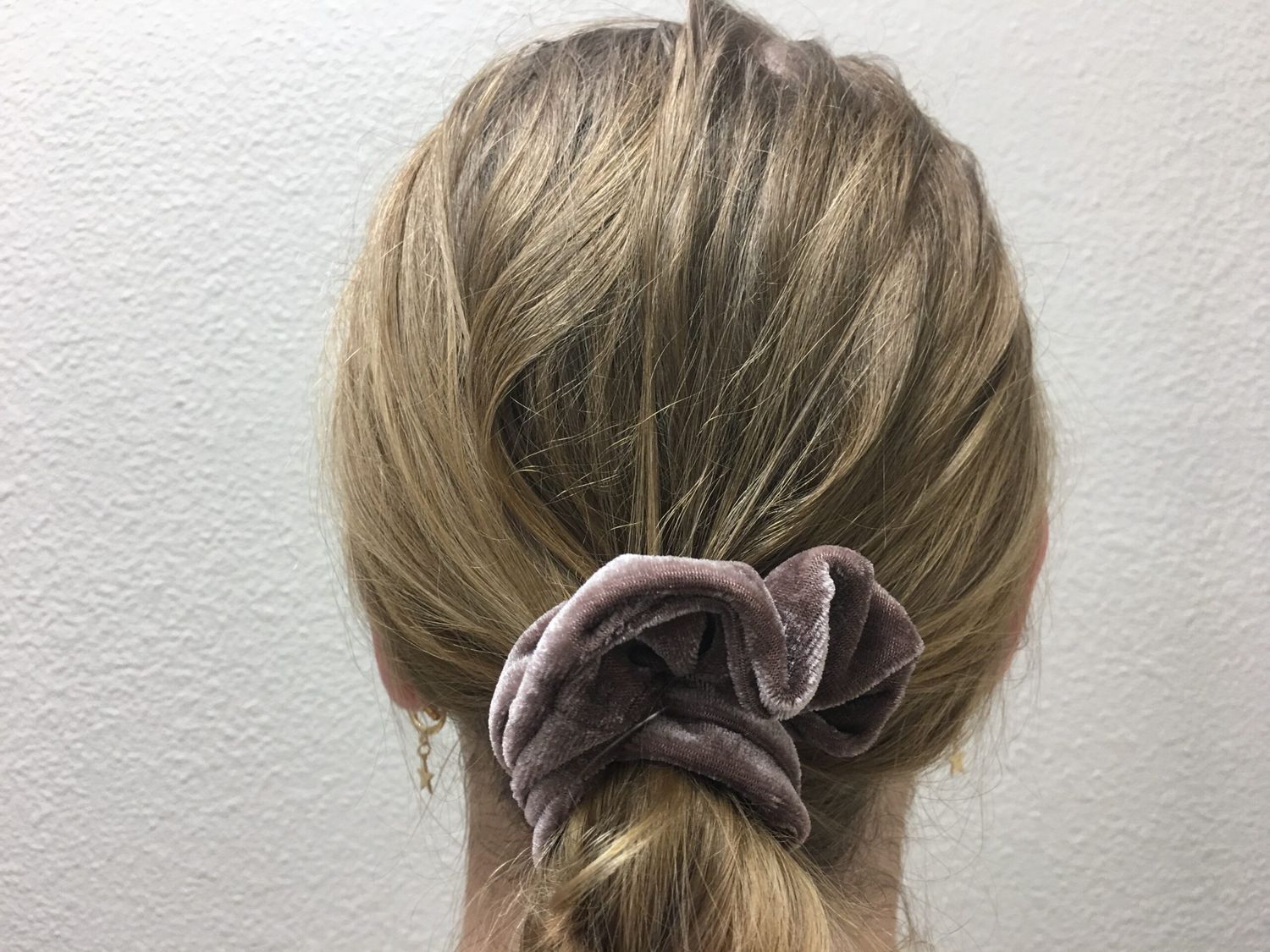 Ear Surgery Before & After