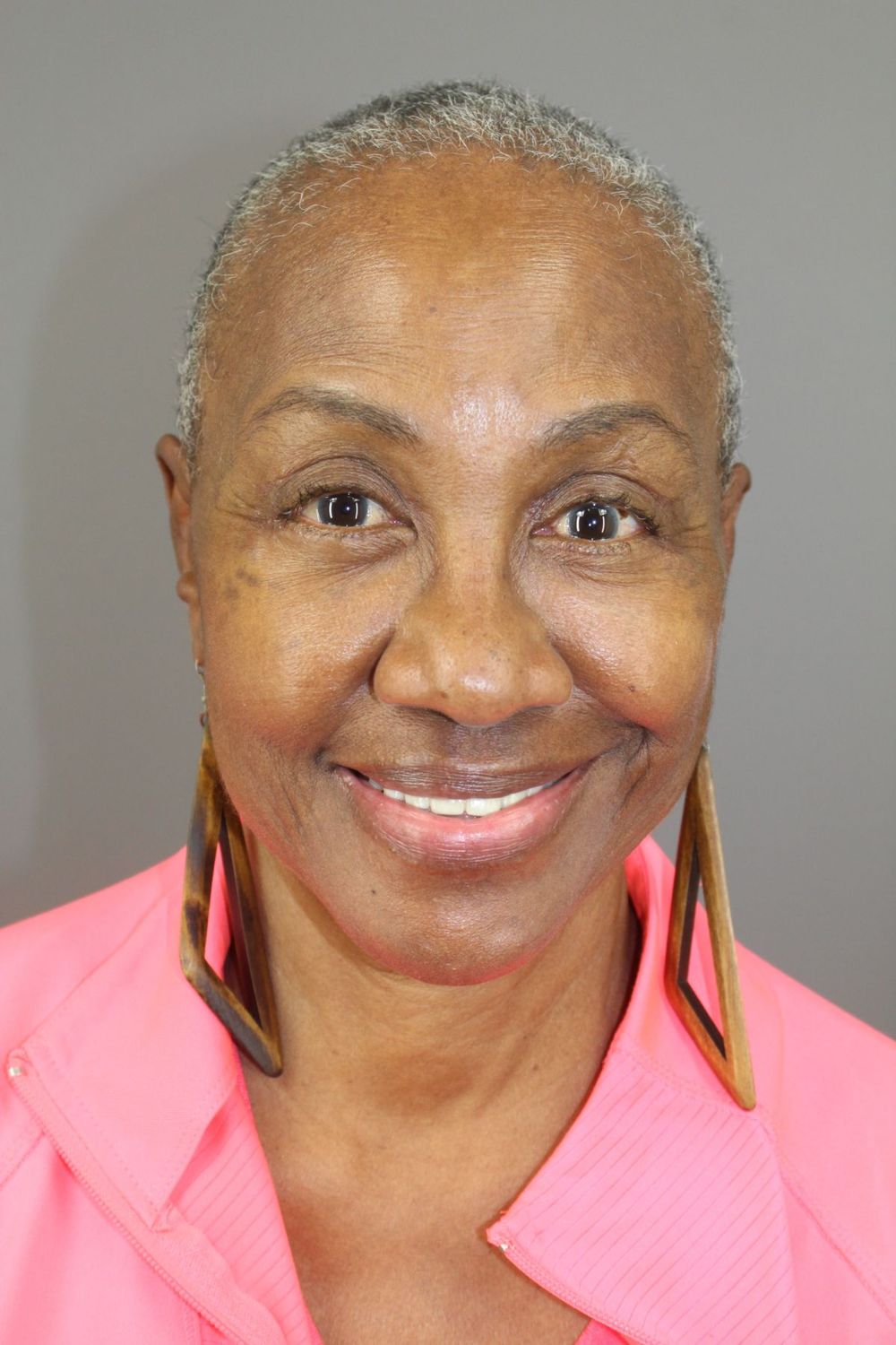 Eyelid Surgery Before & After