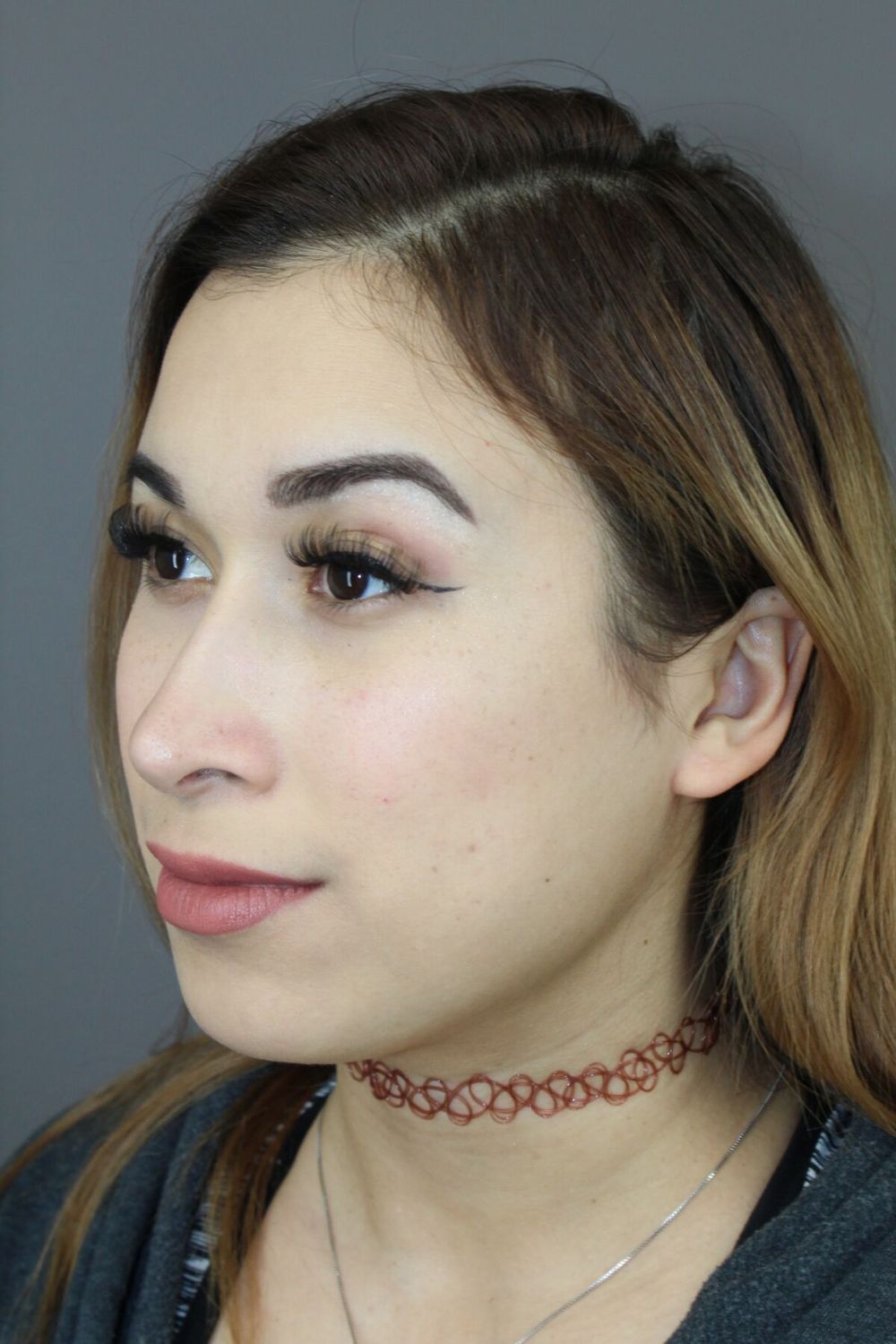 Rhinoplasty Before & After