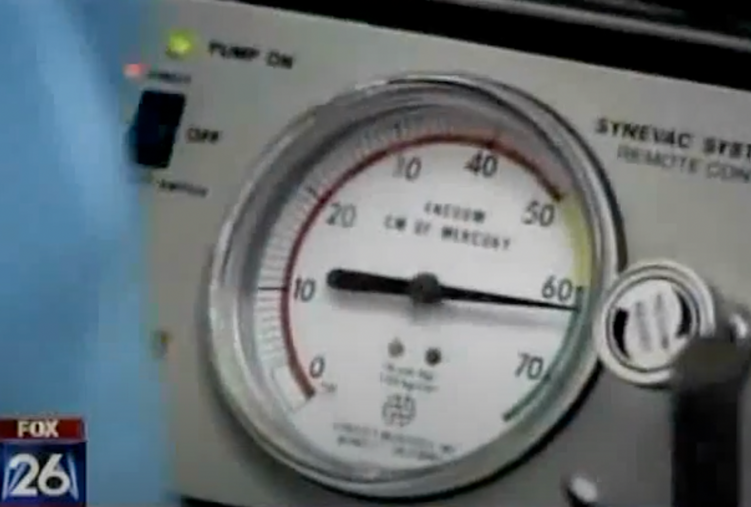 Vacuum pressure gauge in medical equipment display.