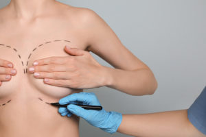 How to get a Perfect Perky Breast Without Surgery