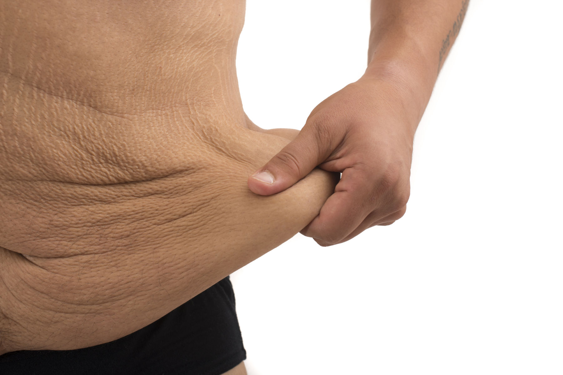 What is excess skin removal surgery